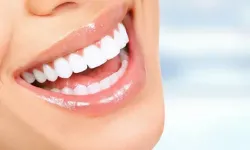 87 KALEM DİŞ SARF MALZEMELERİ ALIMI İHALE İLANI