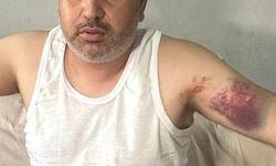 Adana'da yeğenini beyzbol sopasıyla darbeden kişi tutuklandı