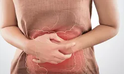 Kolon Kanserinde Erken Tanı Hayat Kurtarıyor