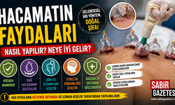 Hacamatın Faydaları /Nasıl Yapılır Neye İyi Gelir?