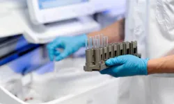 Üroflowmetri Nedir? Nasıl Yapılır?