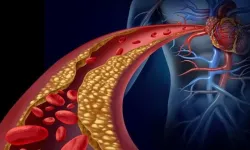 Kandaki yağı düşürmeye yardımcı besinler hangileri?