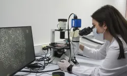 Diş kök hücreleri çikolata kisti tedavisi için umut oldu