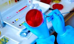 Balgam Kültürü Nedir? Uzayan Öksürüğün Arkasındaki Nedeni Ortaya Çıkarıyor