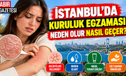 İstanbul'da Kuruluk Egzaması Neden Olur Nasıl Geçer?