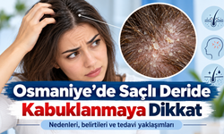Osmaniye’de Saçlı Deride Kabuklanmaya Dikkat