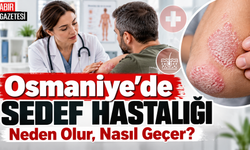Osmaniye'de Sedef Hastalığı Neden Olur Nasıl Geçer?