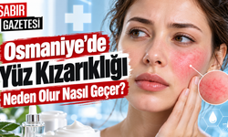 Osmaniye'de Yüz Kızarıklığı Neden Olur Nasıl Geçer?