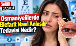 Osmaniyelilerde Blefarit Nasıl Anlaşılır Tedavisi Nedir?