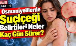Osmaniyelilerde Suçiçeği Belirtileri Neler Kaç Gün Sürer?