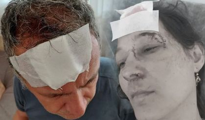 Yalova’da Yazlık Aidat Kavgası Kanlı Bitti