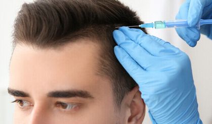 Saç mezoterapisi nedir? Saç dökülmesine gerçekten iyi geliyor mu?