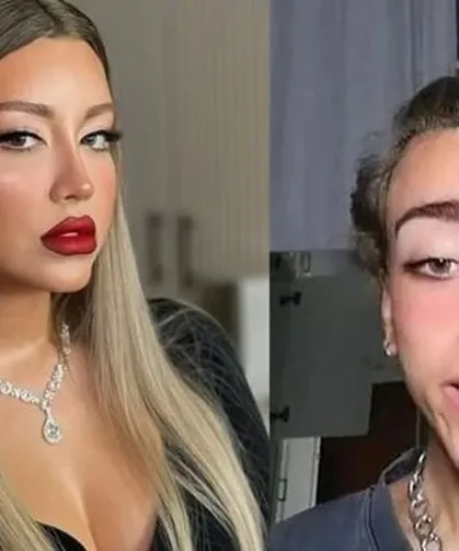 Ünlü Fenomen Mika Raun  Hakkında Şok Gelişme