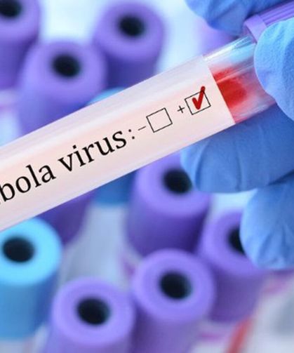 ABD'den Ebola Önlemi: Kongo'dan Dönüşlere Uçuş Kısıtlaması