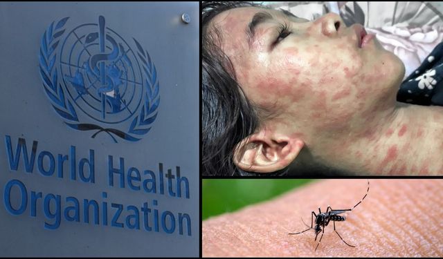 Dünya Sağlık Örgütü'nden Chikungunya alarmı! Bulaşıcı mı, öldürüyor mu?