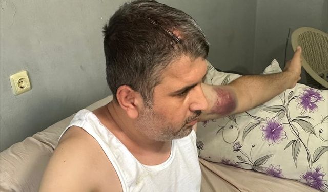 Adana'da dayısı tarafından beyzbol sopasıyla darbedilen kişi yaralandı