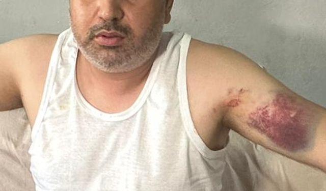 Adana'da yeğenini beyzbol sopasıyla darbeden kişi tutuklandı