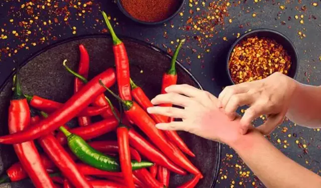 Biber Yanığına Karşı Doğru Müdahale Nasıl Olmalı?