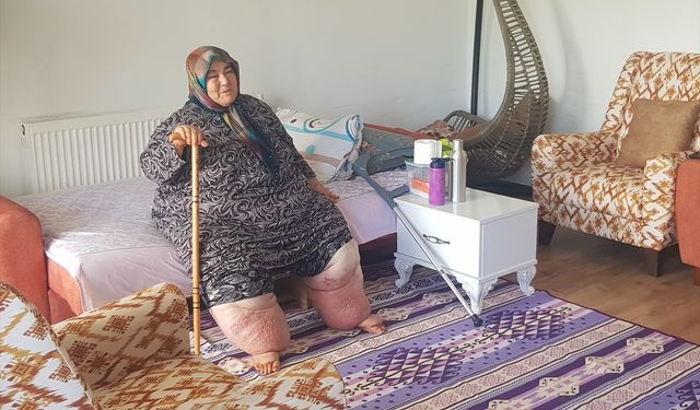 Osmaniye'de yaşayan 160 kilogram ağırlığındaki 'fil hastası' Güler'e tekerlekli sandalye desteği
