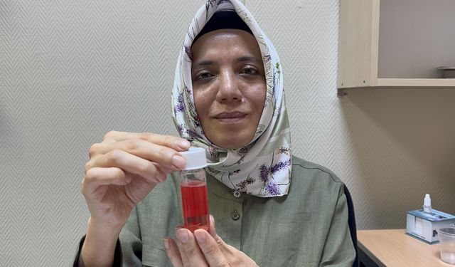 Süleyman Demirel Üniversitesi Göz Bankası 2 yılda 100'den fazla hastaya 'ışık' oldu