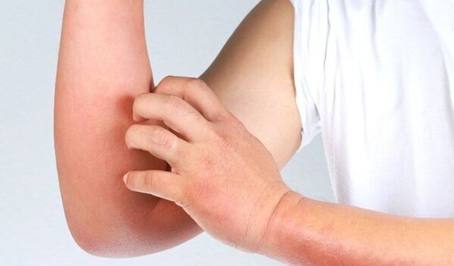 Cilt Sorunlarında En Temel Eksiklik Ortaya Çıktı