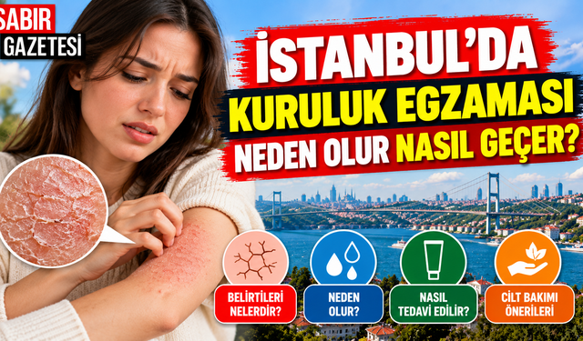 İstanbul'da Kuruluk Egzaması Neden Olur Nasıl Geçer?