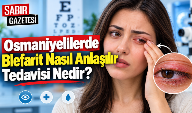 Osmaniyelilerde Blefarit Nasıl Anlaşılır Tedavisi Nedir?