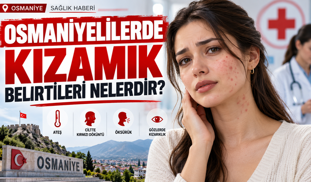 Osmaniyelilerde Kızamık Belirtileri Nelerdir?