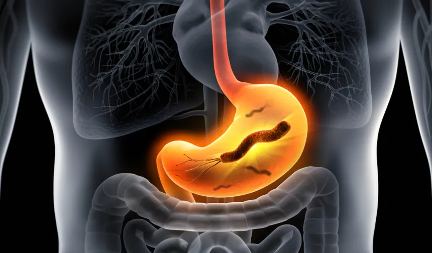 Mide kanseri belirtileri neler? Erken uyarı işaretlerine dikkat