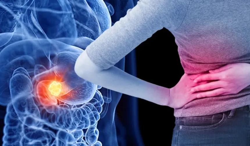 Pankreas Kanseri Nedir? Belirtileri ve Tedavi Yolları