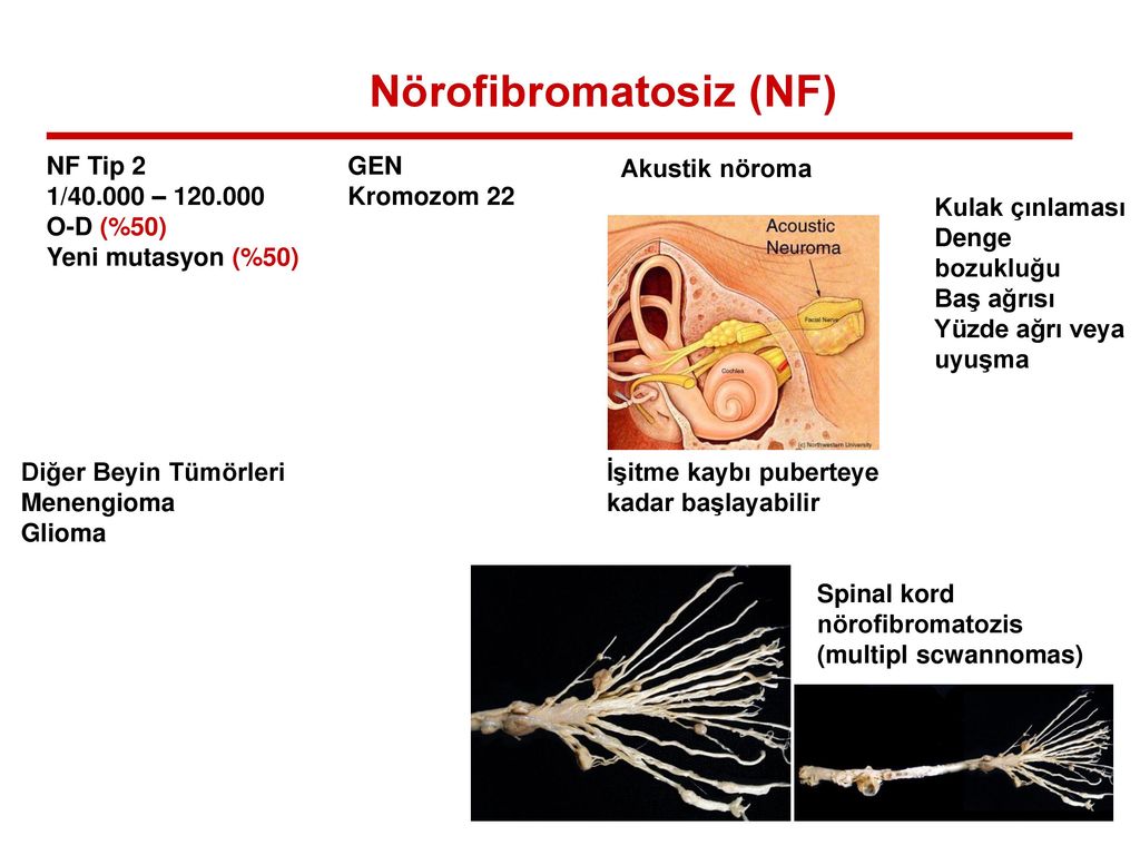 Nf2