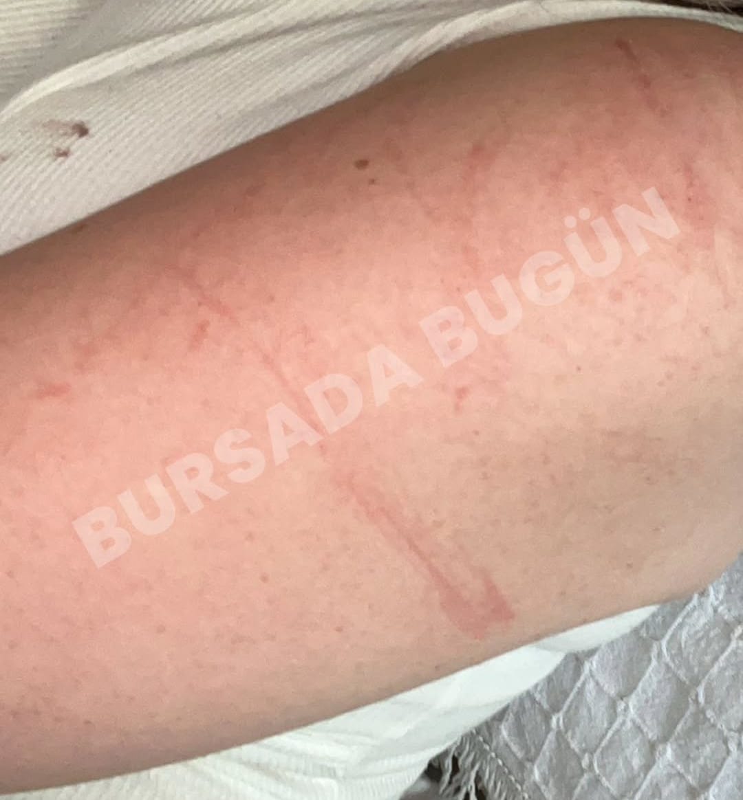 Bursa’da Genç Kıza Bıçaklı Gasp Dehşeti (2)