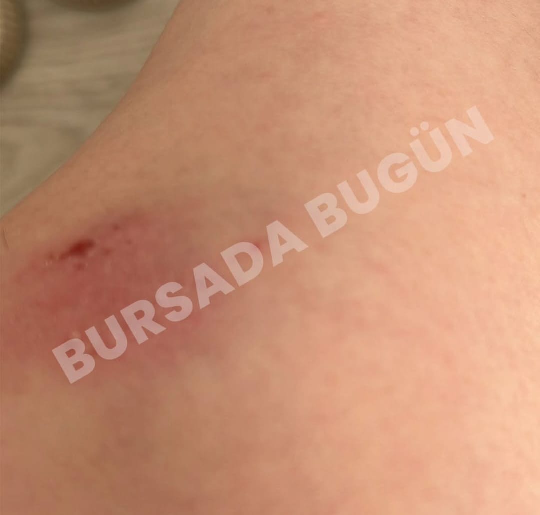 Bursa’da Genç Kıza Bıçaklı Gasp Dehşeti (3)