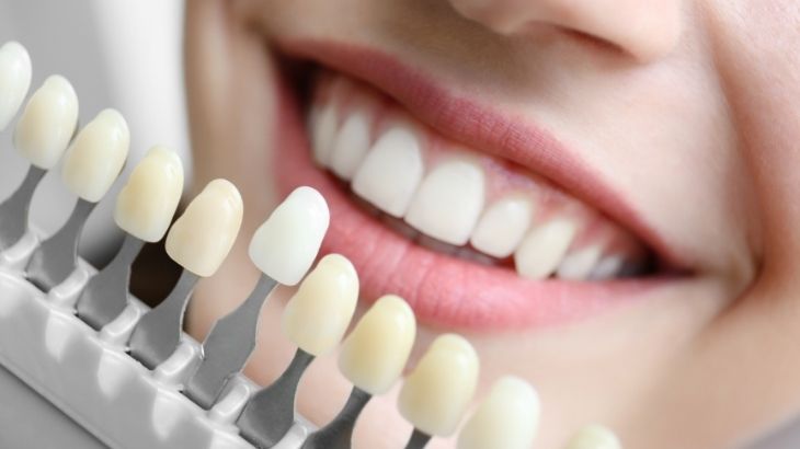 Diş Sararması Neden Olur3