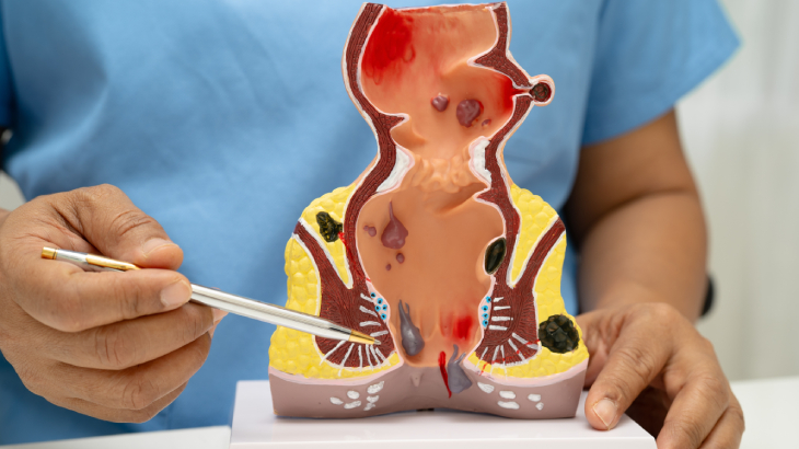 Basura Ne İyi Gelir8