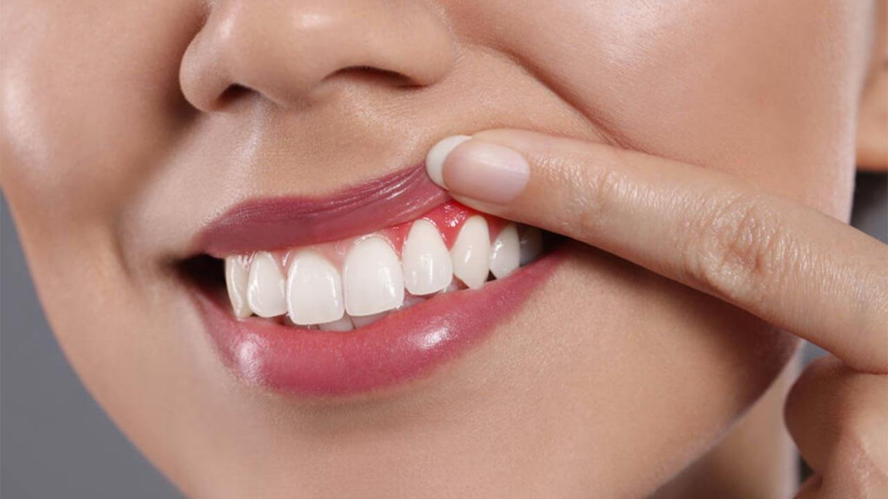 Osmaniyeliler Dikkat Diş Apsesi Hayati Tehlike Yaratabilir2