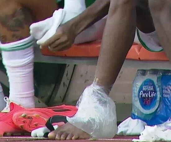 Osimhen Sakatlandı, Liverpool Maçında Durumu Belirsiz (1)