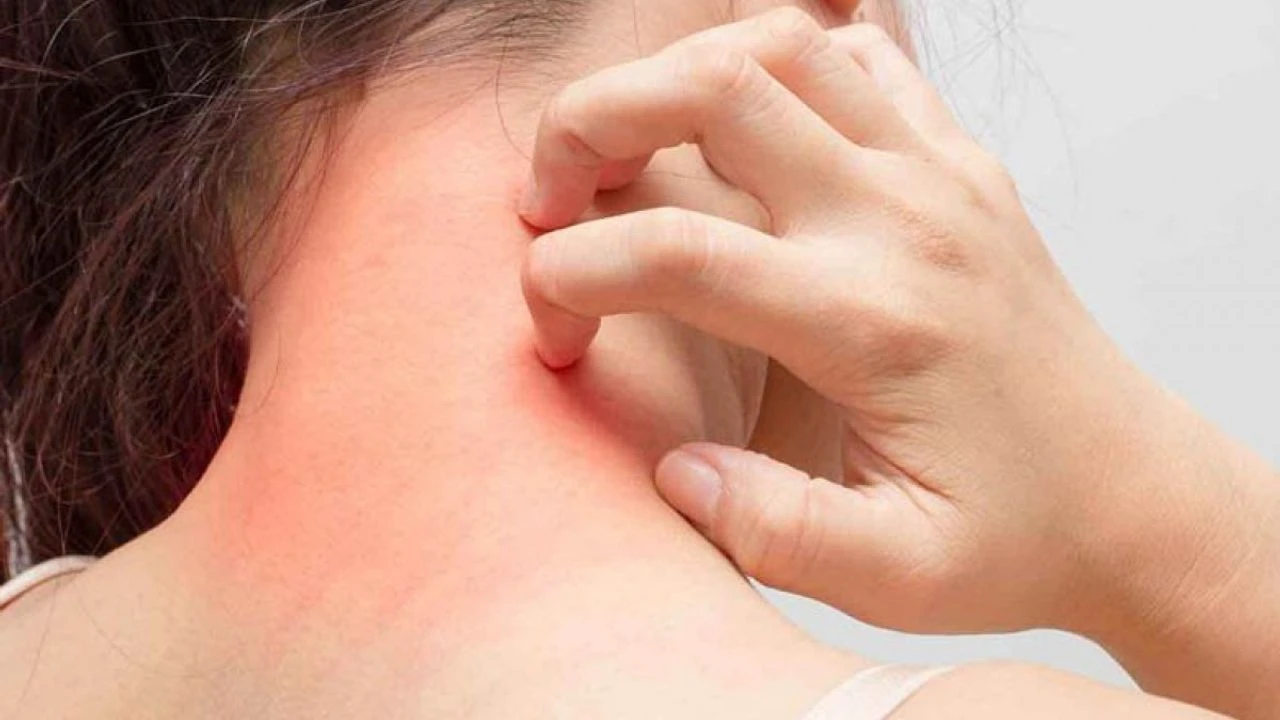 Osmaniyeliler Dikkat Kaşıntınızın Nedeni Stres Olabilir2