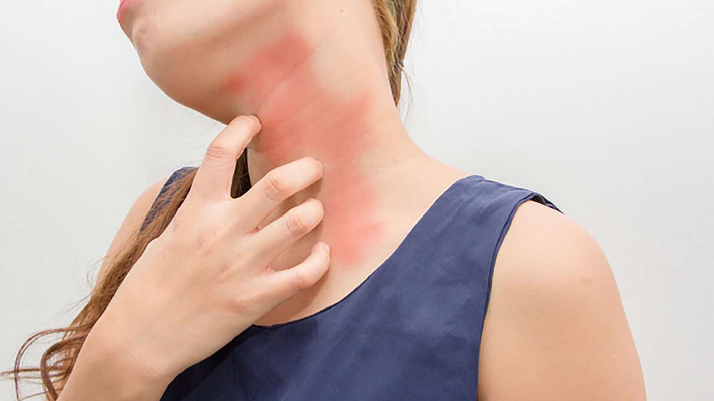 Osmaniyeliler Dikkat Kaşıntınızın Nedeni Stres Olabilir4