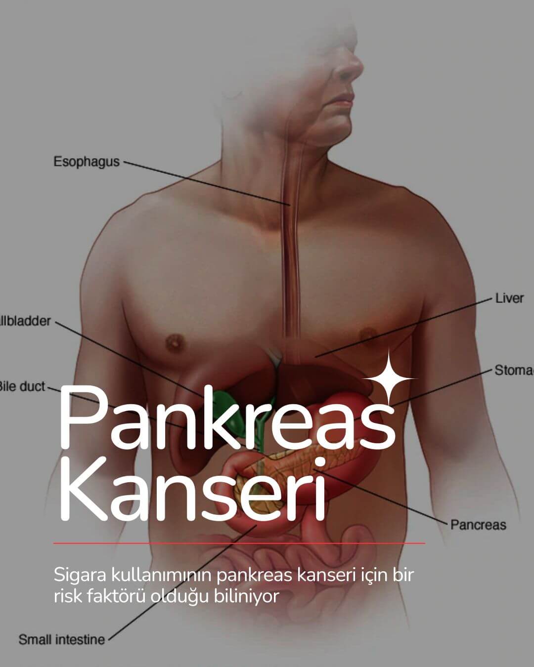Pankreas Kanseri (1)