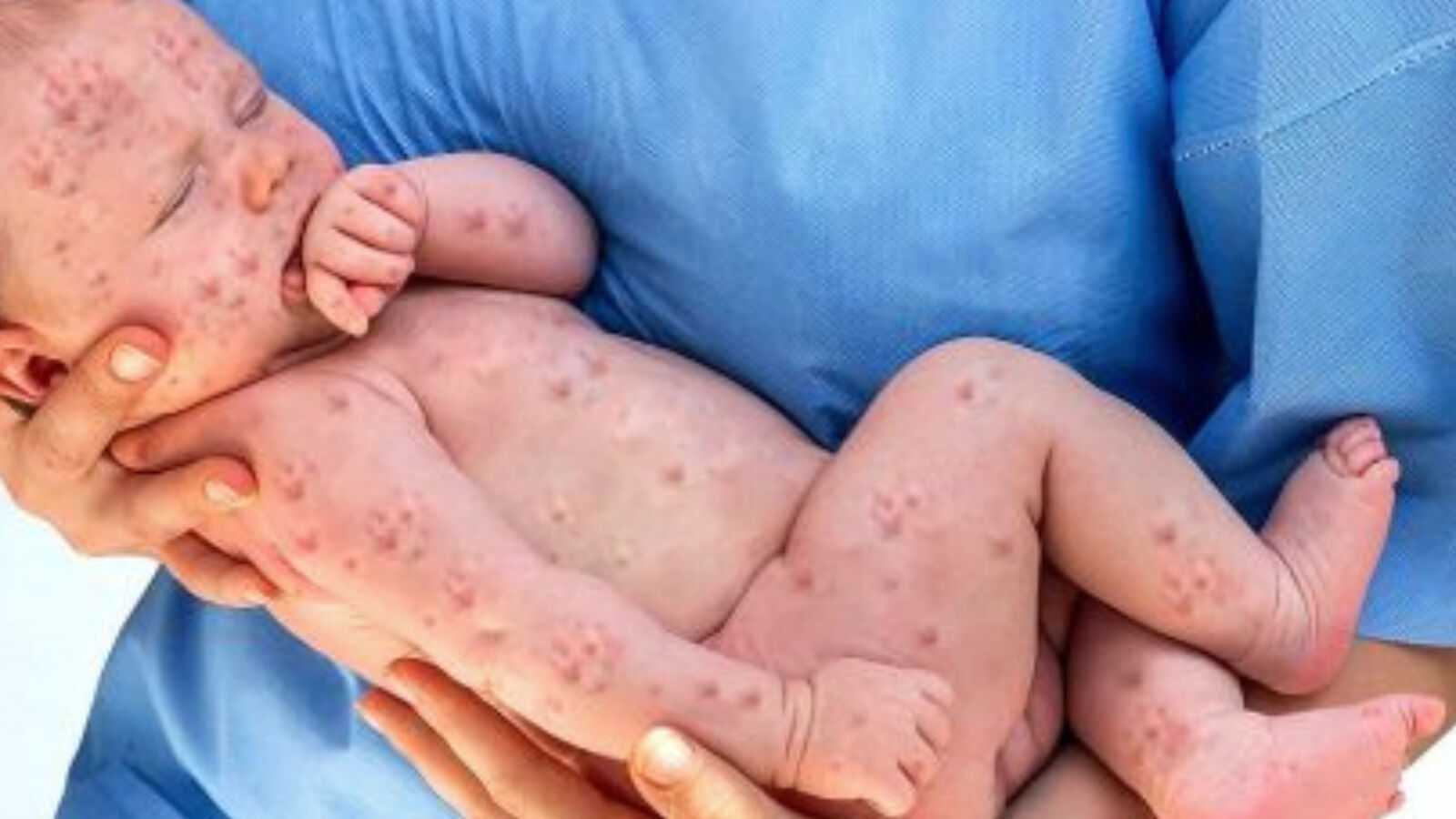 M E N I N G O K O K1