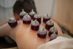 Hacamat Faydalari 300X200