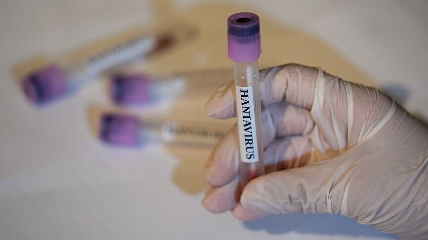 Hantavirus