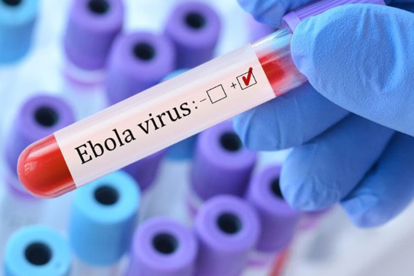 ABD'den Ebola Önlemi: Kongo'dan Dönüşlere Uçuş Kısıtlaması