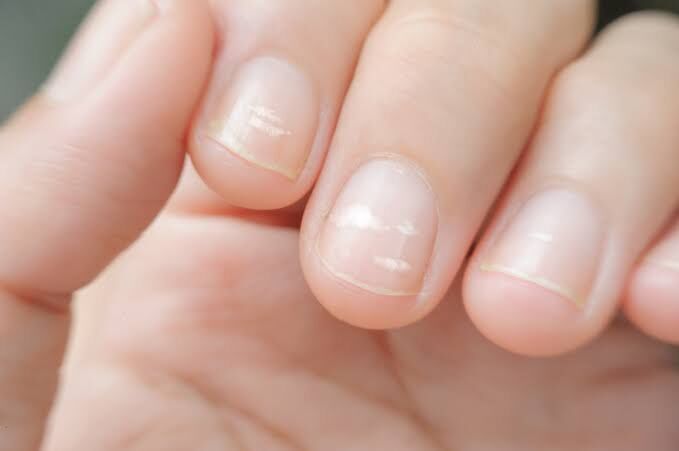 T I R N A K1